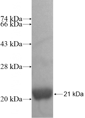 Recombinant Human RPL22L1 SDS-PAGE