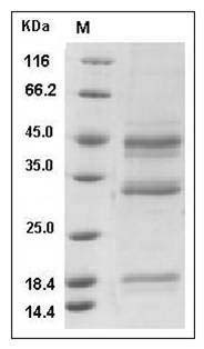 Human Hemojuvelin / HFE2 Protein (His Tag) SDS-PAGE