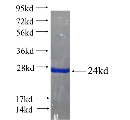 Recombinant human SHROOM2 SDS-PAGE