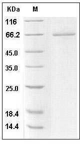 Human CD27 / TNFRSF7 Protein (His & Fc Tag) SDS-PAGE