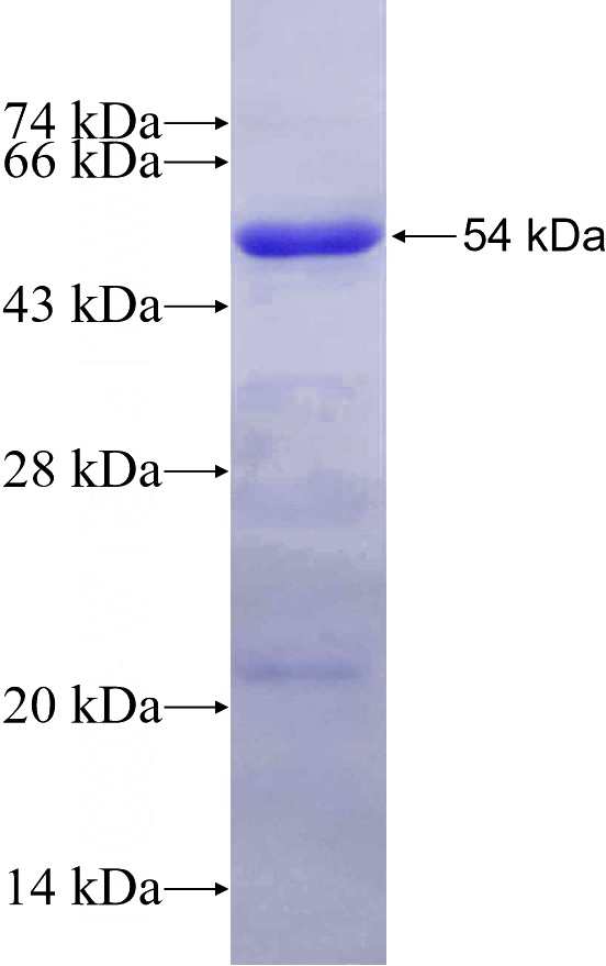 Recombinant Human MDM1 SDS-PAGE