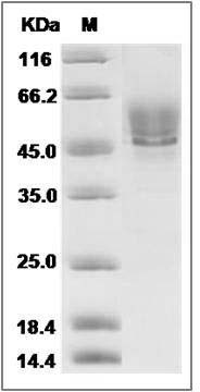 Rat Syndecan-1 / SDC1 / CD138 Protein (His Tag) SDS-PAGE