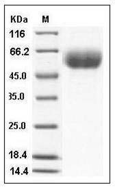 Mouse IL13RA1 Protein (His Tag) SDS-PAGE