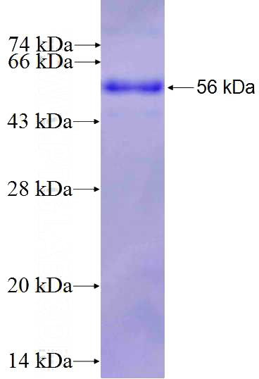 Recombinant Human PRKAB2 SDS-PAGE