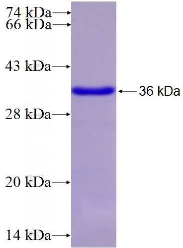 Recombinant Human NEUROG1 SDS-PAGE