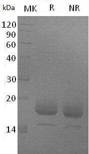 Mouse Il4/Il-4 (His tag) recombinant protein