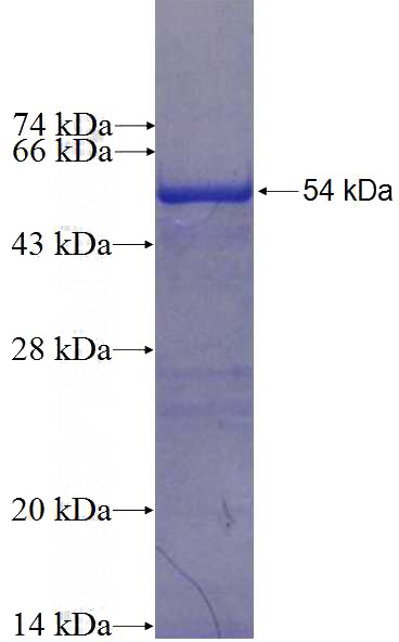 Recombinant Human DDX50 SDS-PAGE
