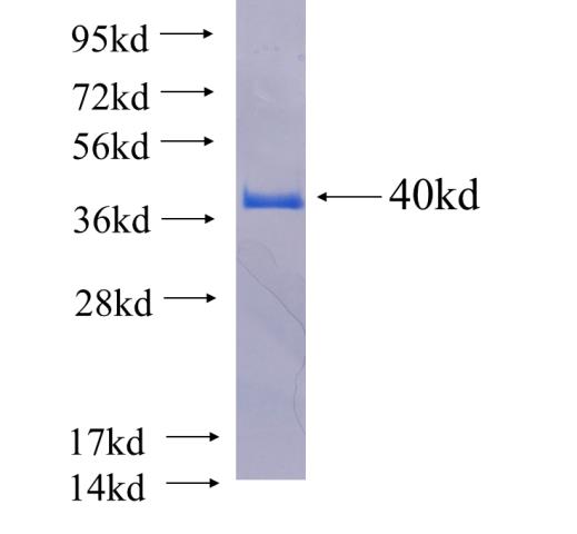 Recombinant human ACC SDS-PAGE