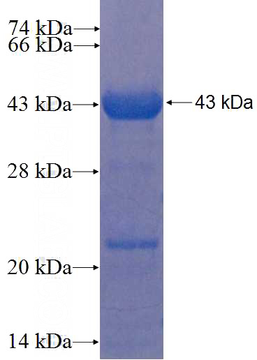 Recombinant Human HGS SDS-PAGE