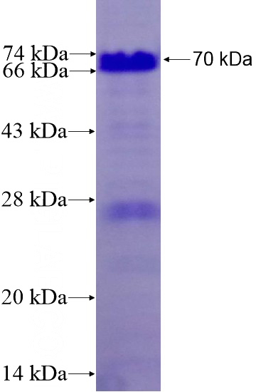 Recombinant Human TEX14 SDS-PAGE