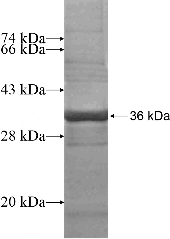 Recombinant Human KIAA0895 SDS-PAGE