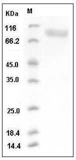 Mouse CD31 / PECAM-1 Protein (His Tag) SDS-PAGE