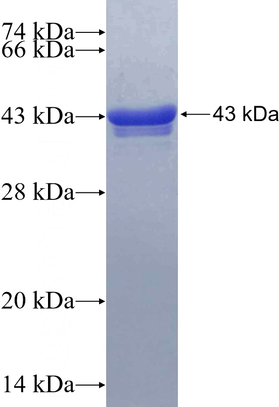 Recombinant Human GREB1 SDS-PAGE