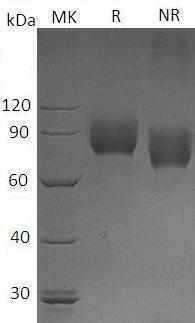 Human CSF1R/FMS (His tag) recombinant protein