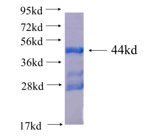 Recombinant human HOXB1 SDS-PAGE