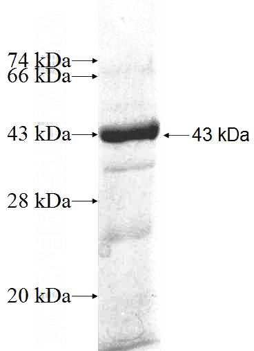 Recombinant Human CDKN2AIP SDS-PAGE