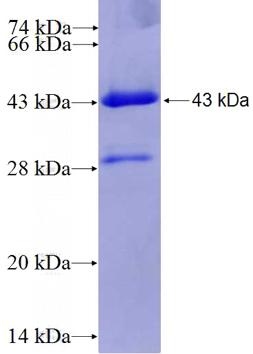 Recombinant Human CYP3A5 SDS-PAGE