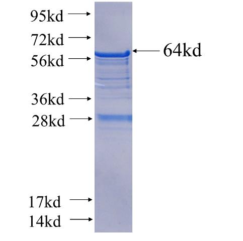 Recombinant human NCRNA00153 SDS-PAGE