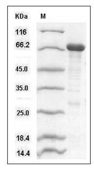 Human RACK1 / GNB2L1 Protein (His & MBP Tag) SDS-PAGE