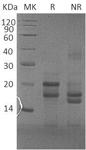 Human PFDN4/PFD4 (His tag) recombinant protein