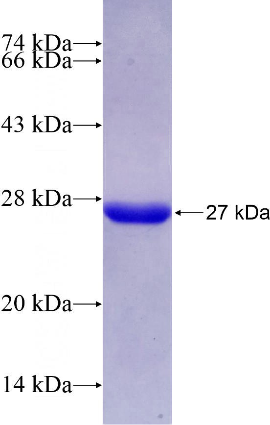 Recombinant Human MOCS2 SDS-PAGE