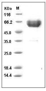 Human TREM1 Protein (His & Fc Tag) SDS-PAGE
