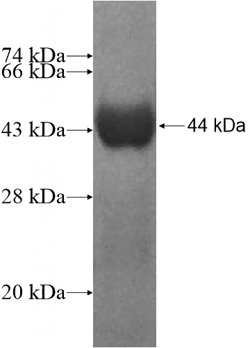 Recombinant Human MYO1C SDS-PAGE