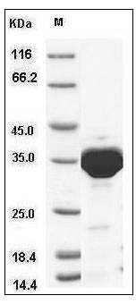 Aequorea victoria GFP Protein (His Tag) SDS-PAGE