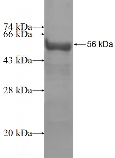 Recombinant Human ZFYVE9 SDS-PAGE