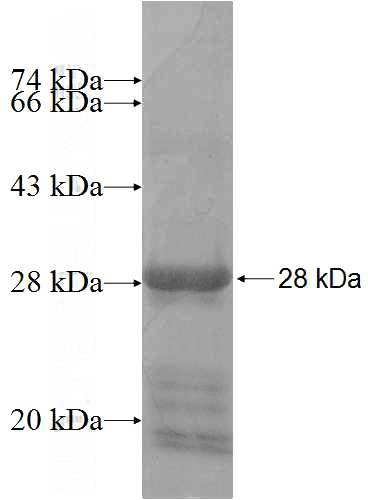 Recombinant Human ATP10A SDS-PAGE