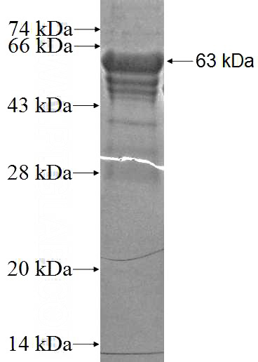Recombinant Human UCHL5 SDS-PAGE