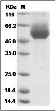 Cynomolgus IL18R1 Protein (His Tag) SDS-PAGE