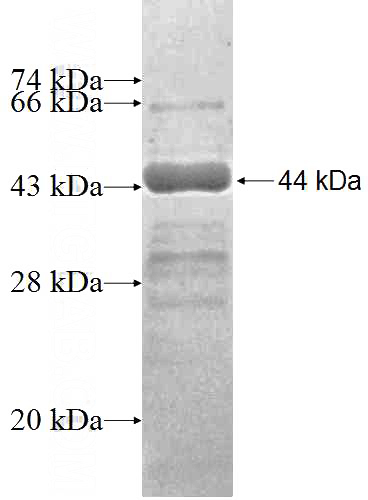 Recombinant Human NOL6 SDS-PAGE