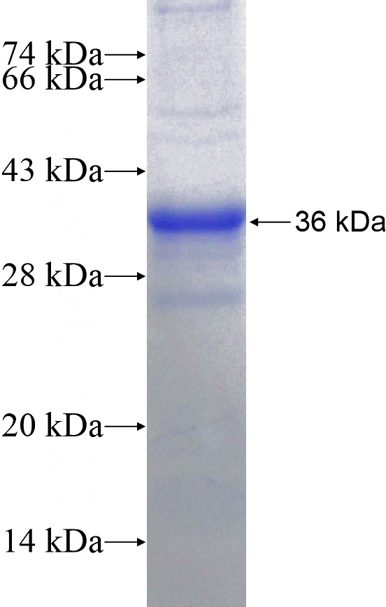 Recombinant Human RDH12 SDS-PAGE