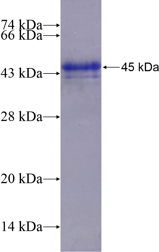 Recombinant Human TCF21 SDS-PAGE