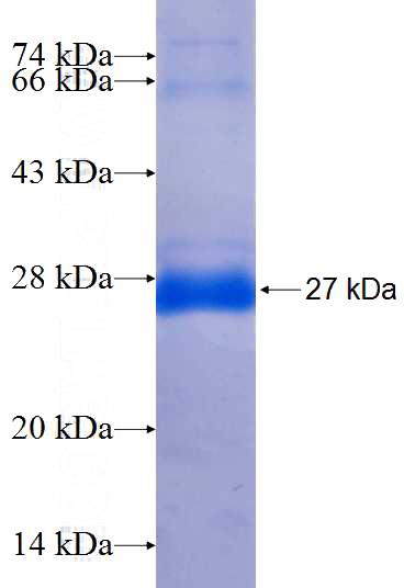 Recombinant Human SAR1A SDS-PAGE