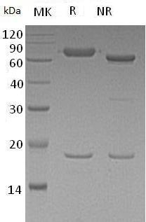 Human PCSK9/NARC1/PSEC0052 (AVI tag) recombinant protein