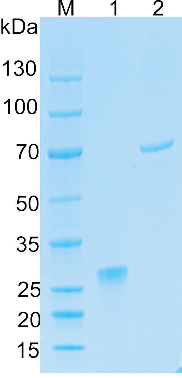 Recombinant Human ADAM10 SDS-PAGE