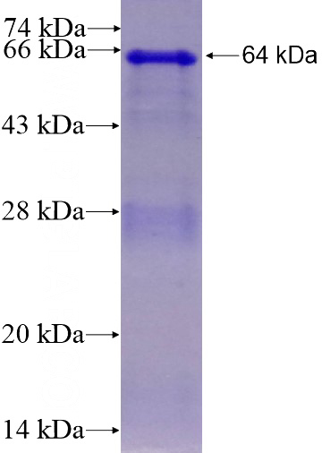 Recombinant Human RPAP2 SDS-PAGE