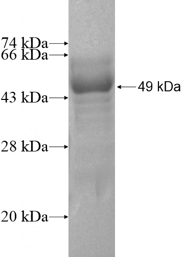 Recombinant Human RAB9B SDS-PAGE