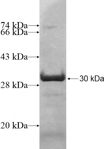 Recombinant Human TOR1AIP1 SDS-PAGE