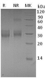 Human TNFRSF9/CD137/ILA (His tag) recombinant protein