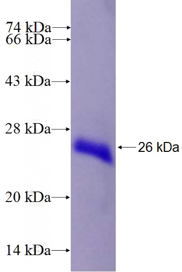 Recombinant Human CIDEB SDS-PAGE