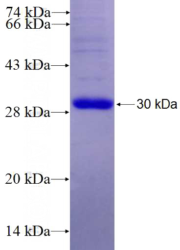 Recombinant Human RHOJ SDS-PAGE