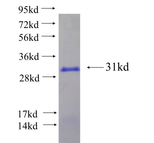 Recombinant human RGL3 SDS-PAGE