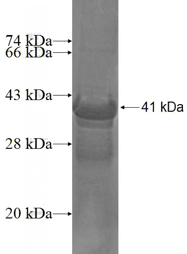 Recombinant Human CRY2 SDS-PAGE