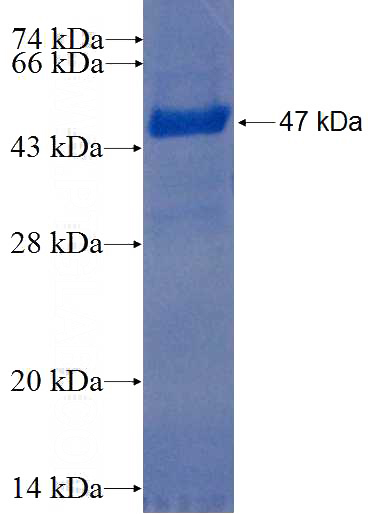 Recombinant Human KCTD9 SDS-PAGE
