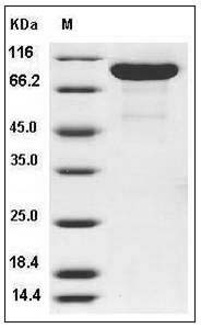 Rat MMP-9 / CLG4B Protein (His Tag) SDS-PAGE