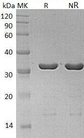 Human LGALS8 recombinant protein