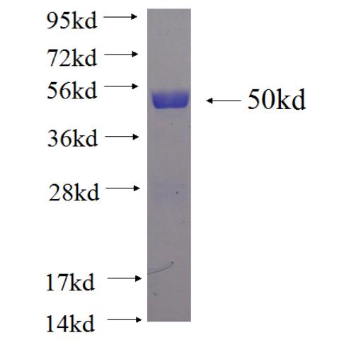 Recombinant human RAN SDS-PAGE